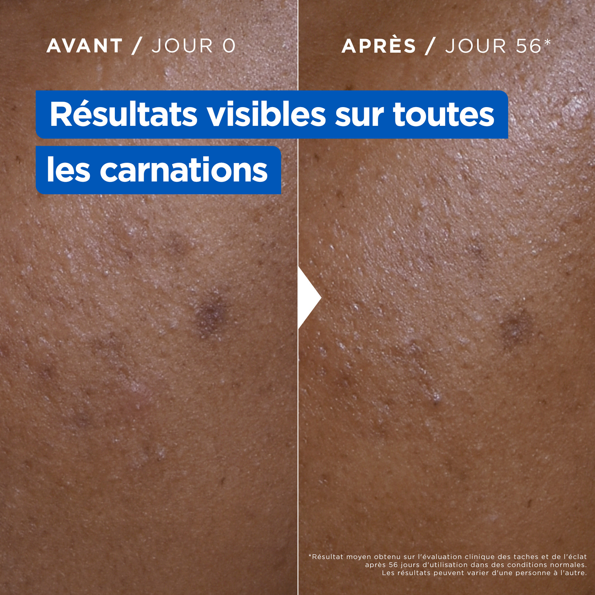 La Crème Niacinamide Correction Eclat - Visage, Corps, Mains – Image 4